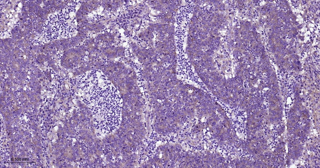 Clathrin Heavy Chain Antibody in Immunohistochemistry (Paraffin) (IHC (P))