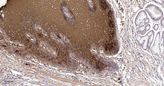 Involucrin Antibody in Immunohistochemistry (Paraffin) (IHC (P))
