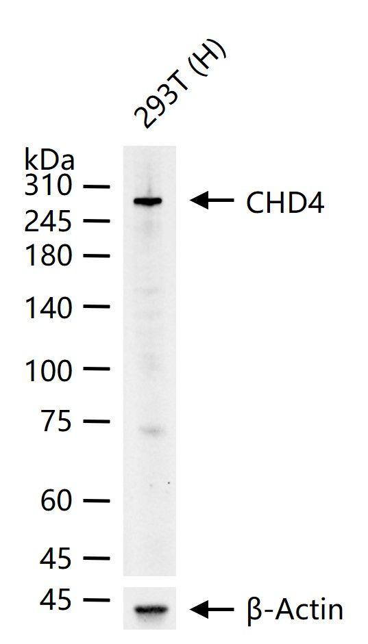 CHD4 Antibody in Western Blot (WB)