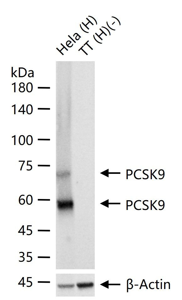 PCSK9 Antibody in Western Blot (WB)