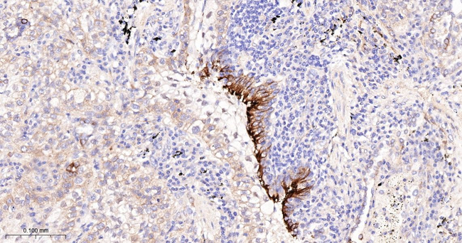 B7-H3 Antibody in Immunohistochemistry (Paraffin) (IHC (P))