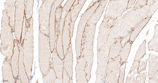 Alpha Sarcoglycan Antibody in Immunohistochemistry (Paraffin) (IHC (P))