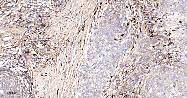 BNIP3L Antibody in Immunohistochemistry (Paraffin) (IHC (P))