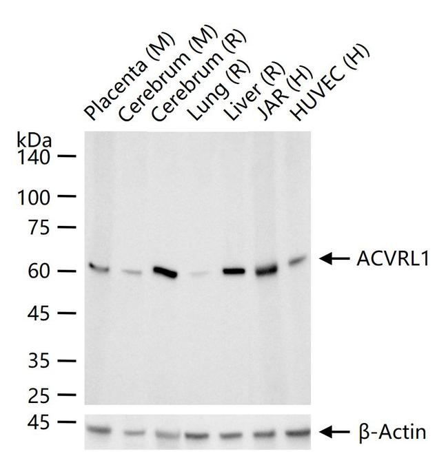 ACVRL1 Antibody in Western Blot (WB)