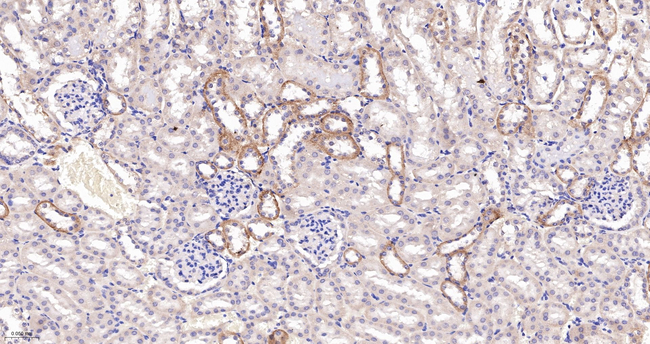 N-WASP Antibody in Immunohistochemistry (Paraffin) (IHC (P))