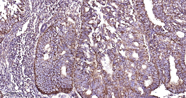 ERAB Antibody in Immunohistochemistry (Paraffin) (IHC (P))