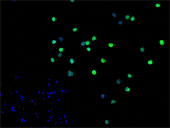 CDT1 Antibody in Immunocytochemistry (ICC/IF)
