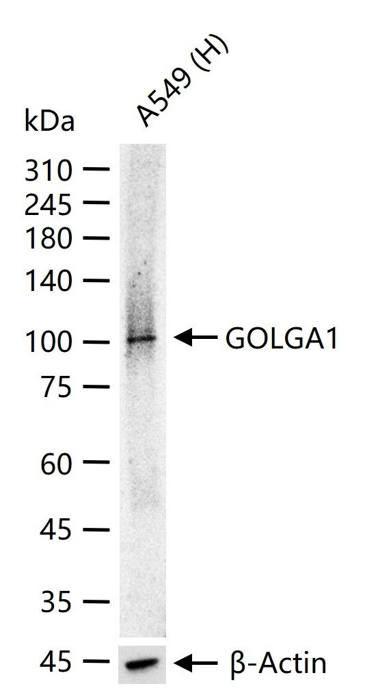 Golgin-97 Antibody in Western Blot (WB)