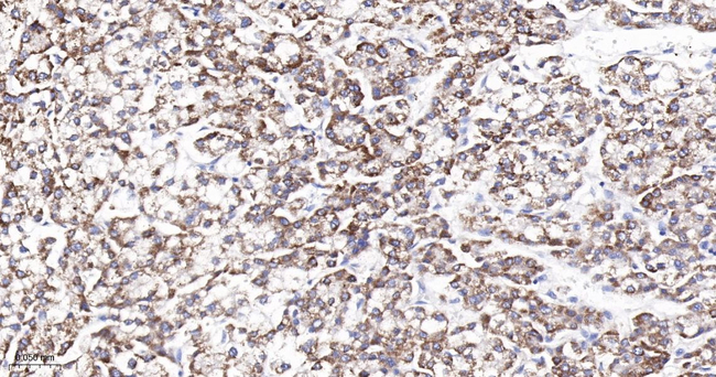PDCD4 Antibody in Immunohistochemistry (Paraffin) (IHC (P))