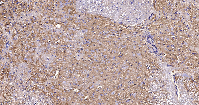 SPTAN1 Antibody in Immunohistochemistry (Paraffin) (IHC (P))