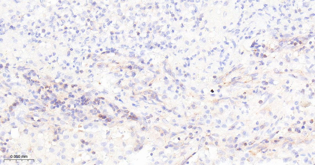 BAG3 Antibody in Immunohistochemistry (Paraffin) (IHC (P))