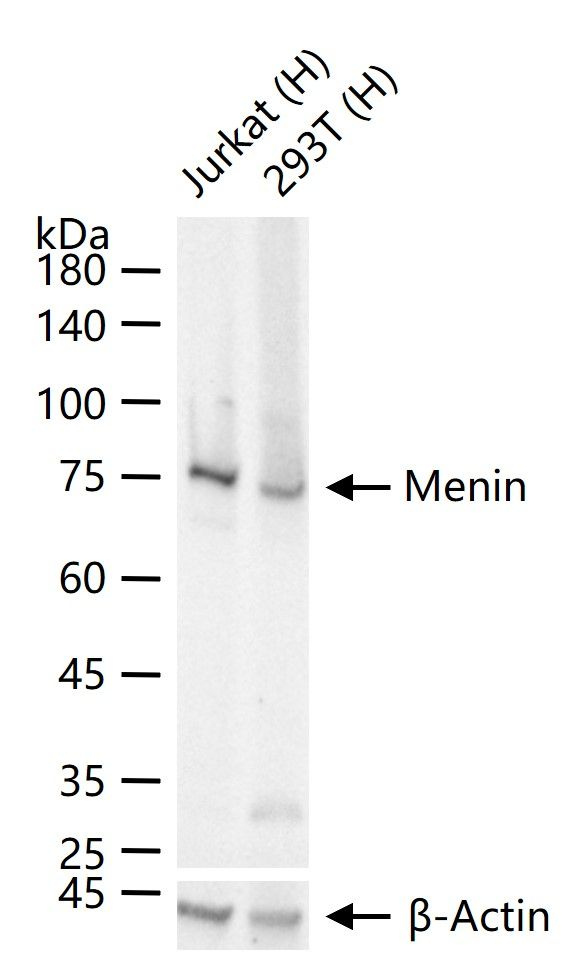 Menin Antibody in Western Blot (WB)