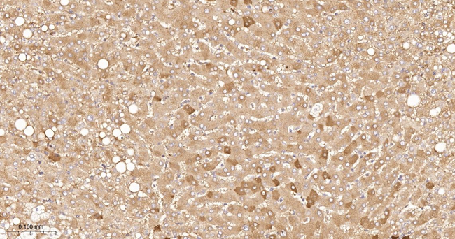 ApoC3 Antibody in Immunohistochemistry (Paraffin) (IHC (P))