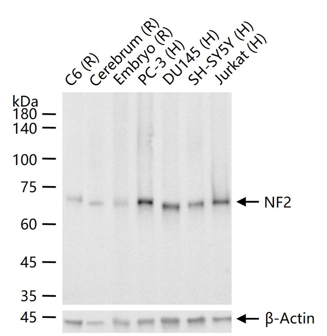 NF2 Antibody in Western Blot (WB)