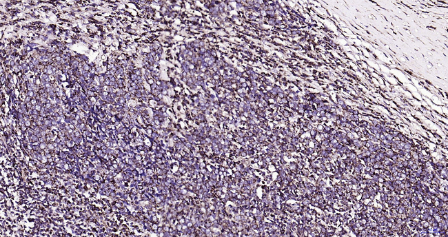 CEACAM6 Antibody in Immunohistochemistry (Paraffin) (IHC (P))