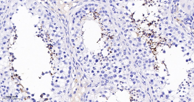 FTMT Antibody in Immunohistochemistry (Paraffin) (IHC (P))