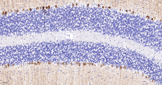 IP3 Receptor 1 Antibody in Immunohistochemistry (Paraffin) (IHC (P))
