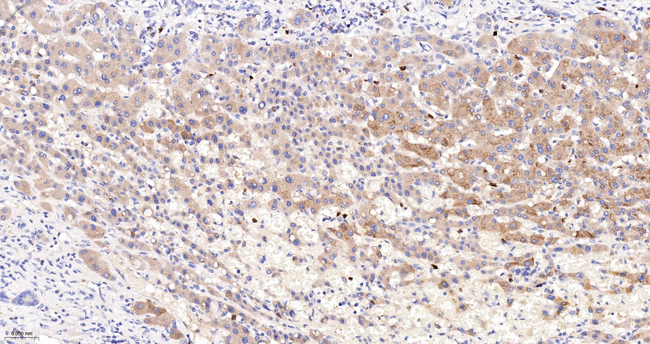ORM1 Antibody in Immunohistochemistry (Paraffin) (IHC (P))