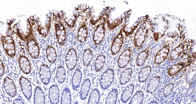 Carbonic Anhydrase II Antibody in Immunohistochemistry (Paraffin) (IHC (P))
