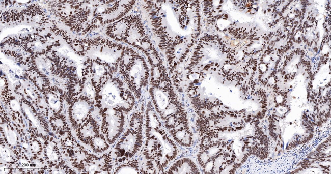 CHK2 Antibody in Immunohistochemistry (Paraffin) (IHC (P))