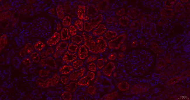 RBP4 Antibody in Immunohistochemistry (Paraffin) (IHC (P))
