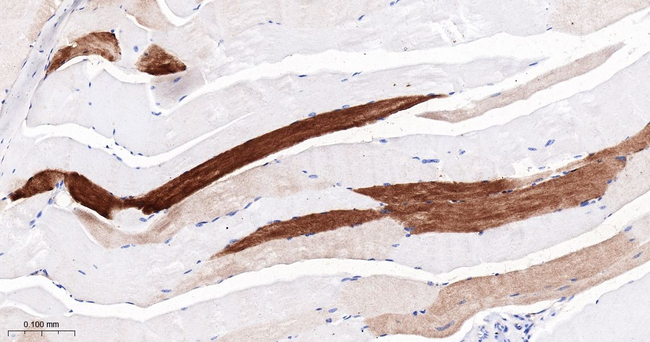 FABP3 Antibody in Immunohistochemistry (Paraffin) (IHC (P))