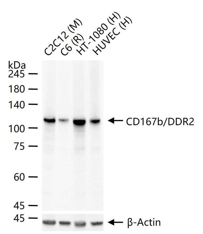 DDR2 Antibody in Western Blot (WB)