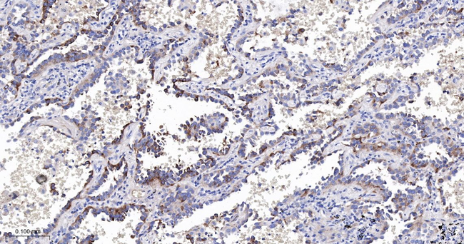 RASSF1 Antibody in Immunohistochemistry (Paraffin) (IHC (P))