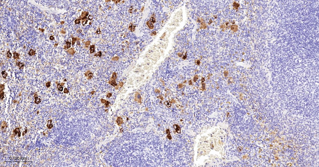 PF4 Antibody in Immunohistochemistry (Paraffin) (IHC (P))