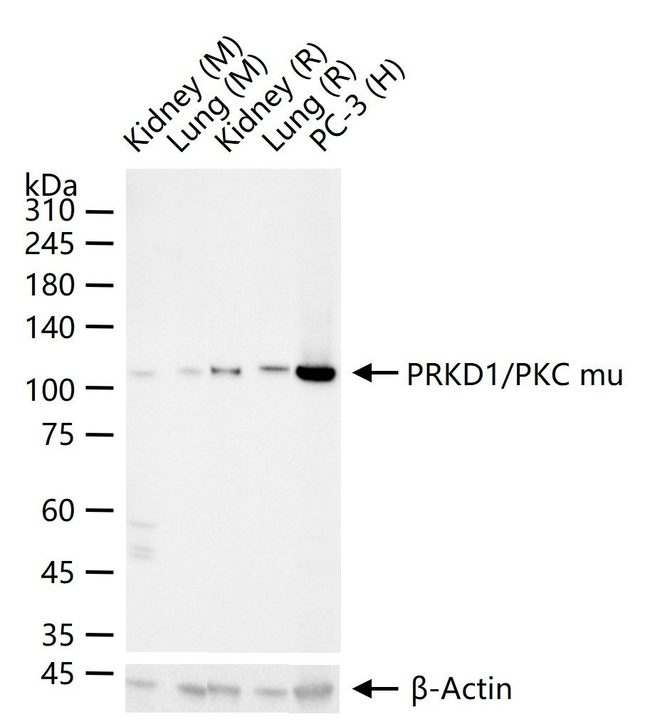 PKC mu Antibody in Western Blot (WB)