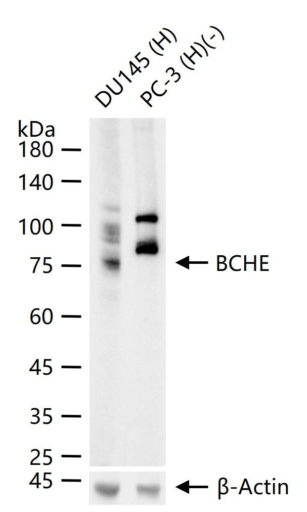 Butyrylcholinesterase Antibody in Western Blot (WB)