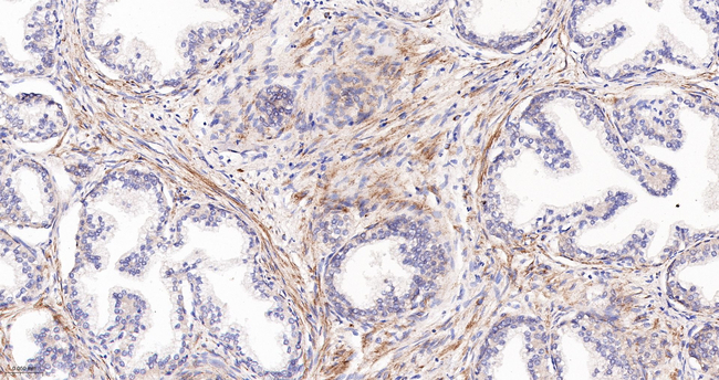 EDG2 Antibody in Immunohistochemistry (Paraffin) (IHC (P))
