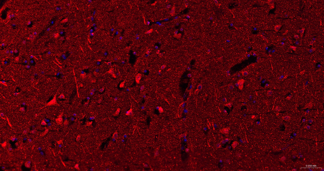SLIT2 Antibody in Immunohistochemistry (Paraffin) (IHC (P))
