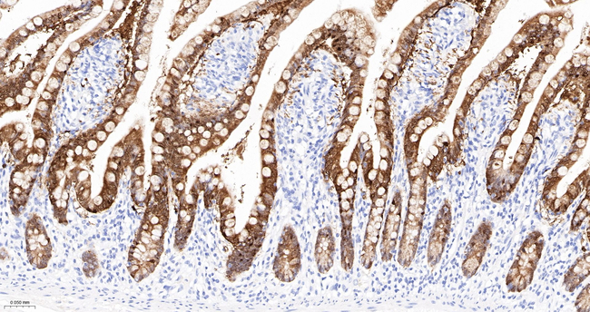 Galectin 4 Antibody in Immunohistochemistry (Paraffin) (IHC (P))