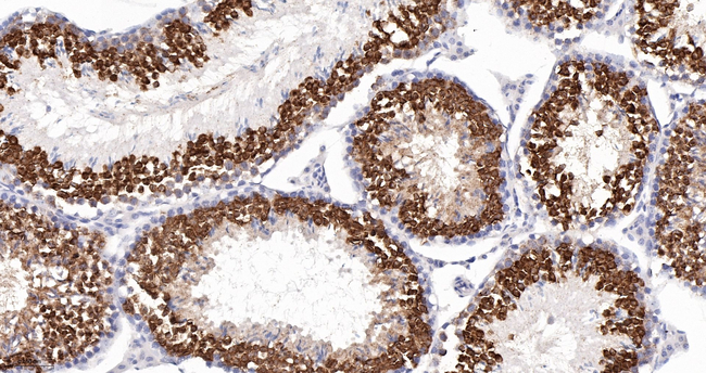 CLGN Antibody in Immunohistochemistry (Paraffin) (IHC (P))