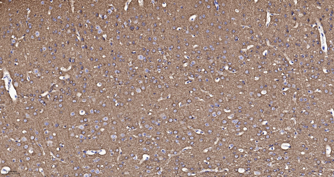 Dynamin 1 Antibody in Immunohistochemistry (Paraffin) (IHC (P))