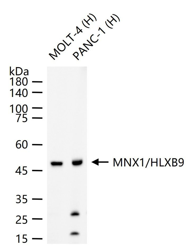 HB9 Antibody in Western Blot (WB)