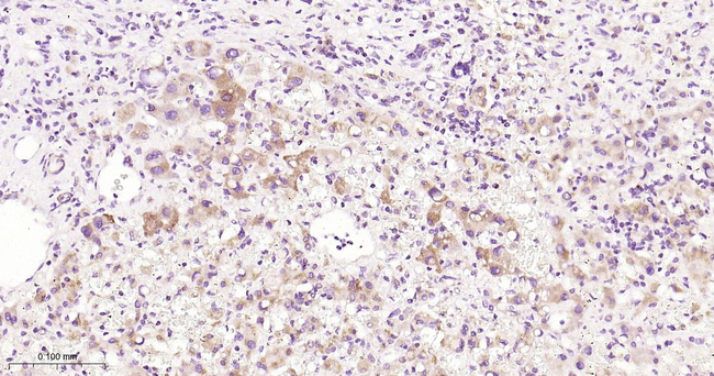 NDUFS3 Antibody in Immunohistochemistry (Paraffin) (IHC (P))