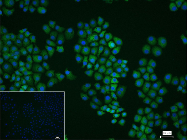 Fascin Antibody in Immunocytochemistry (ICC/IF)