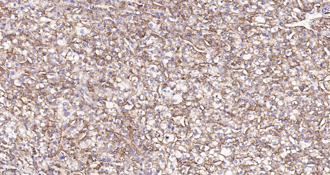 NDRG1 Antibody in Immunohistochemistry (Paraffin) (IHC (P))