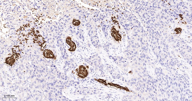 CD235a Antibody in Immunohistochemistry (Paraffin) (IHC (P))