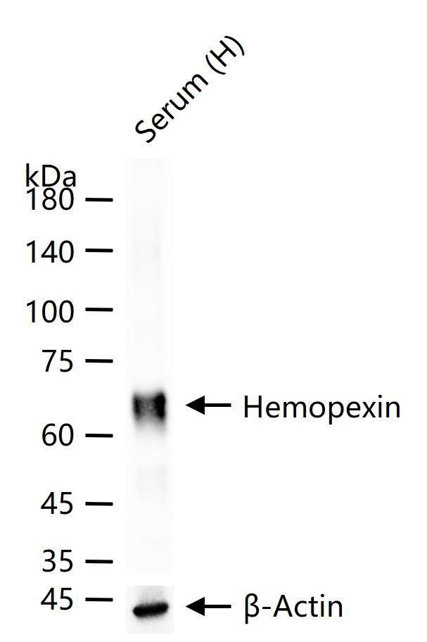 Hemopexin Antibody in Western Blot (WB)