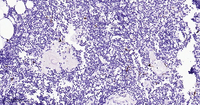 Langerin Antibody in Immunohistochemistry (Paraffin) (IHC (P))