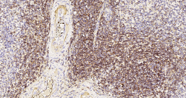 LCK Antibody in Immunohistochemistry (Paraffin) (IHC (P))