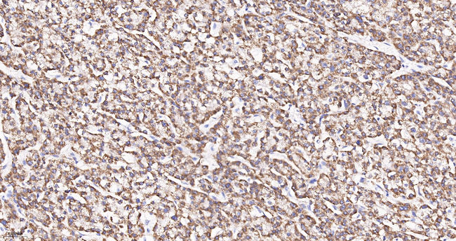 UQCRC2 Antibody in Immunohistochemistry (Paraffin) (IHC (P))