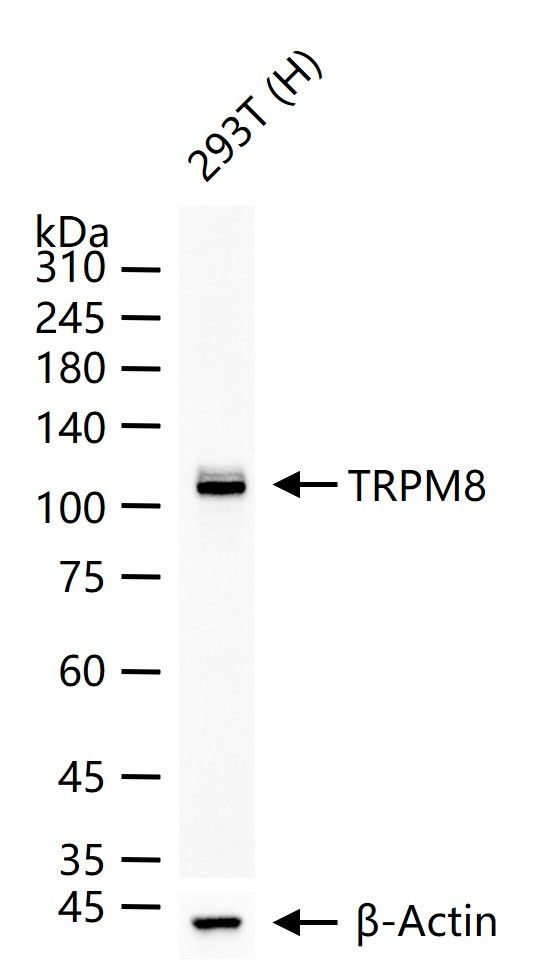 TRPM8 Antibody in Western Blot (WB)