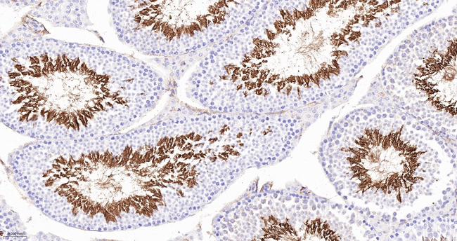 ACE Antibody in Immunohistochemistry (Paraffin) (IHC (P))