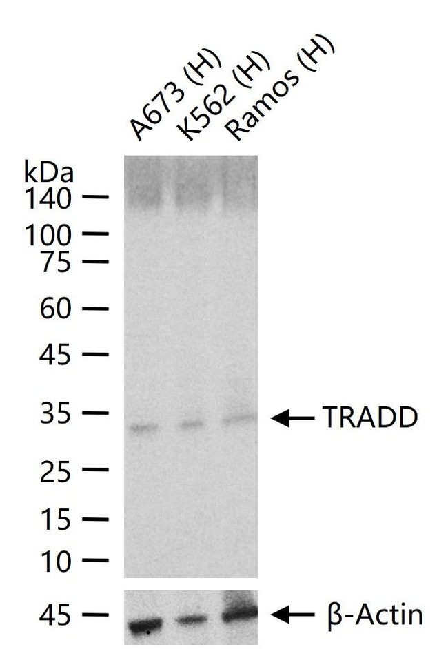 TRADD Antibody in Western Blot (WB)