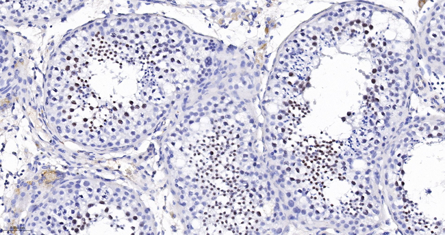 RAP80 Antibody in Immunohistochemistry (Paraffin) (IHC (P))