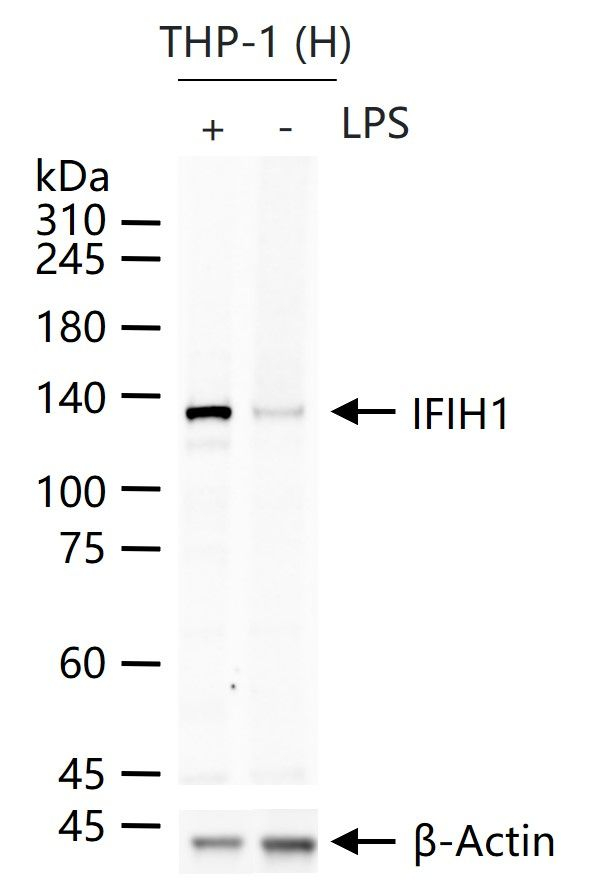 MDA5 Antibody in Western Blot (WB)
